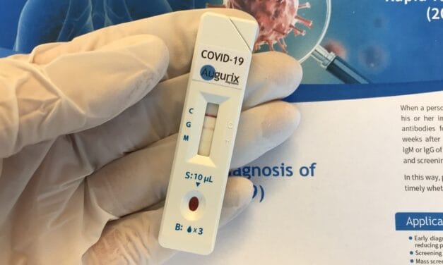 Covid-19: Testes realizados na Suíça (em alemão)
