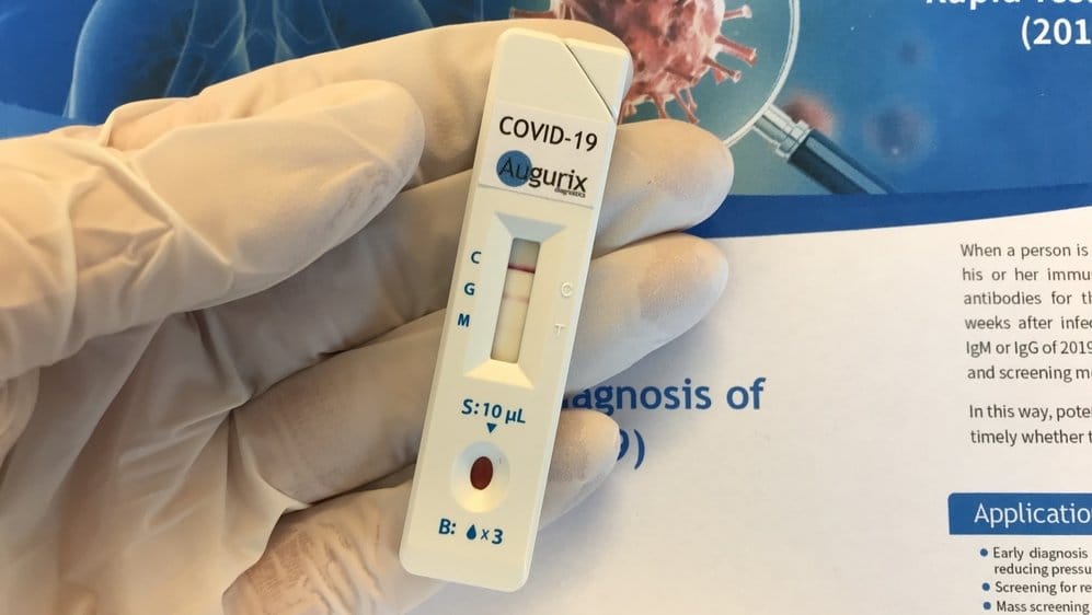 Covid-19: Testes realizados na Suíça (em alemão)